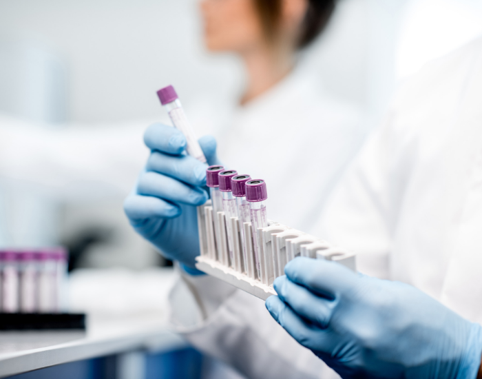 Дешевые тесты отцовства: 3 вещи, которых нужно остерегаться