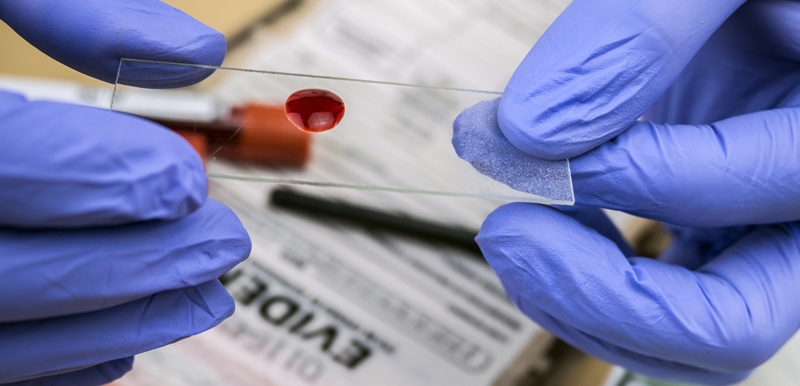 DNA Phenotyping: Is Forensic Analysis Leveling Up?